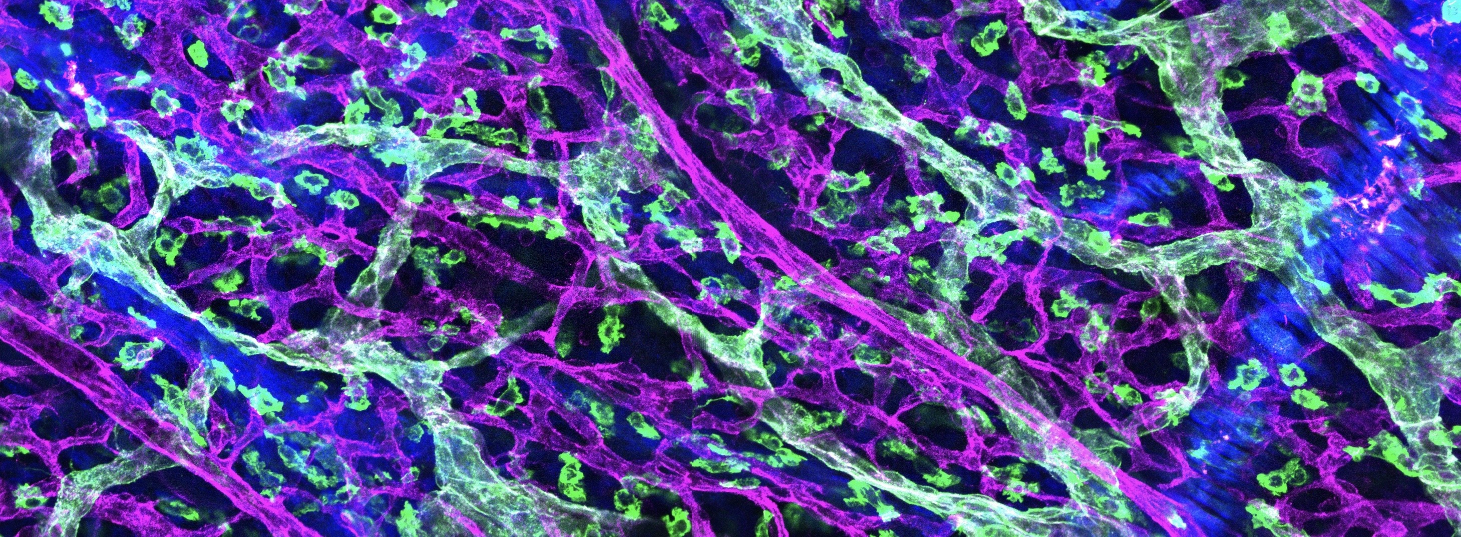 Embryonic skin whole mount stained for lymphatics (green) and blood vessels (magenta).